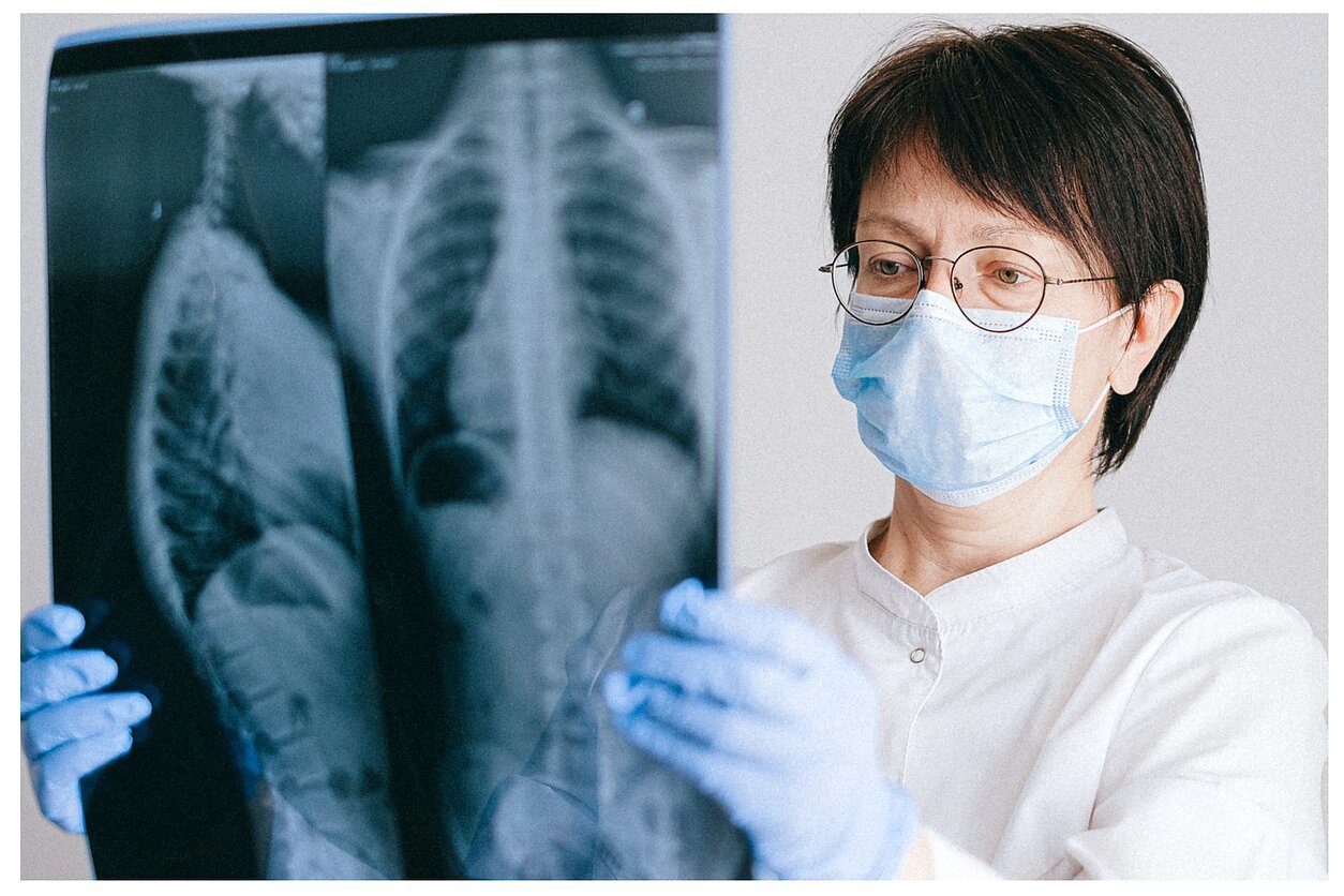 Onkologinės ligos pagalba