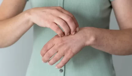 Vabzdžių įgėlimai patarimai kaip apsisaugoti