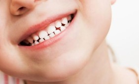 Vaikų dantų priežiūra
