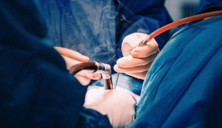 Transplantacija