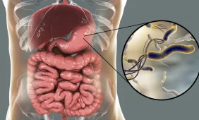 Helicobacter pylori bakterija