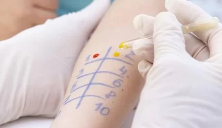Alergija gydytojo atsakymai