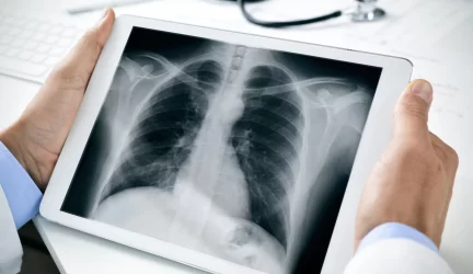 Radiologija
