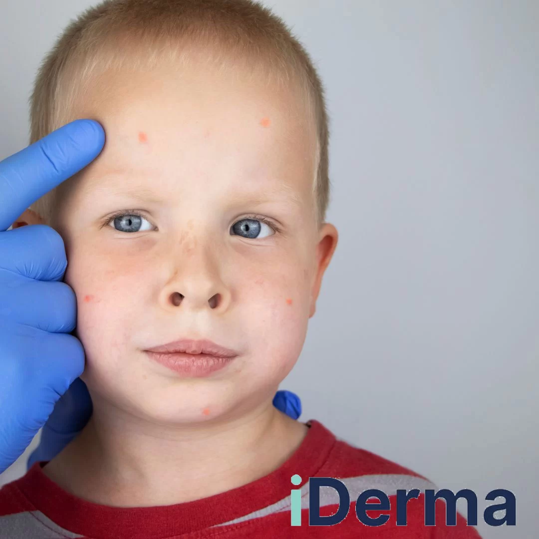Vaikų dermatologas
