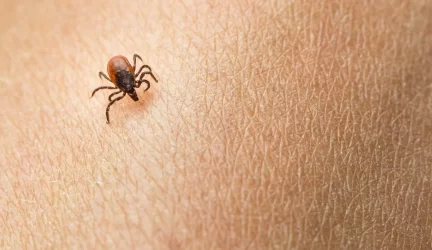 Infekcinės ligos erkės