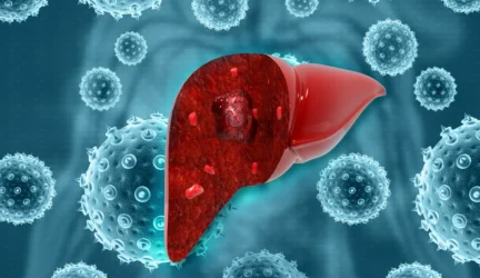 Hepatitas C