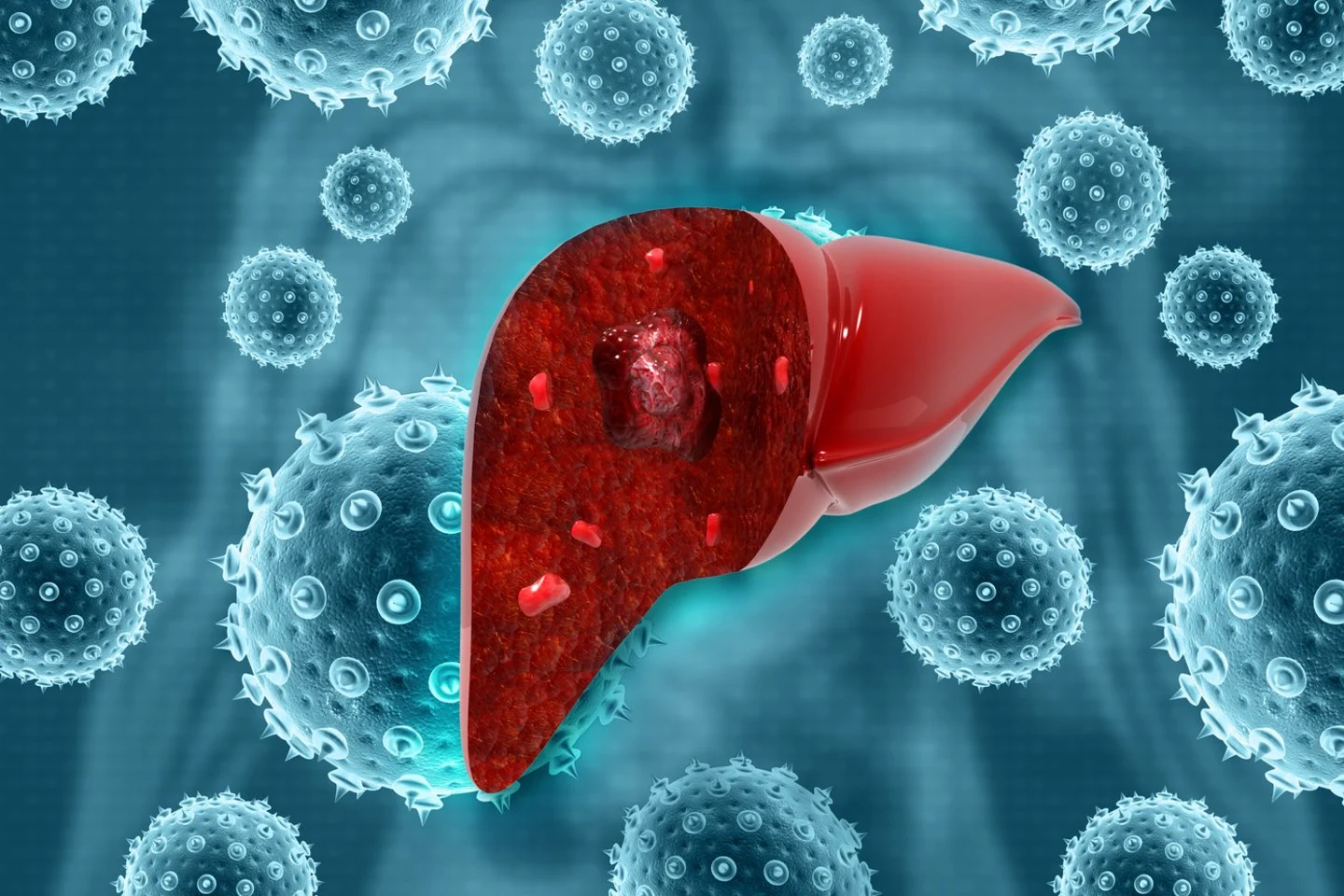Hepatitas C