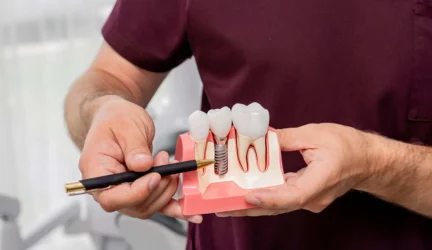 Dantų implantacija be skausmo