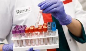 Rezus
