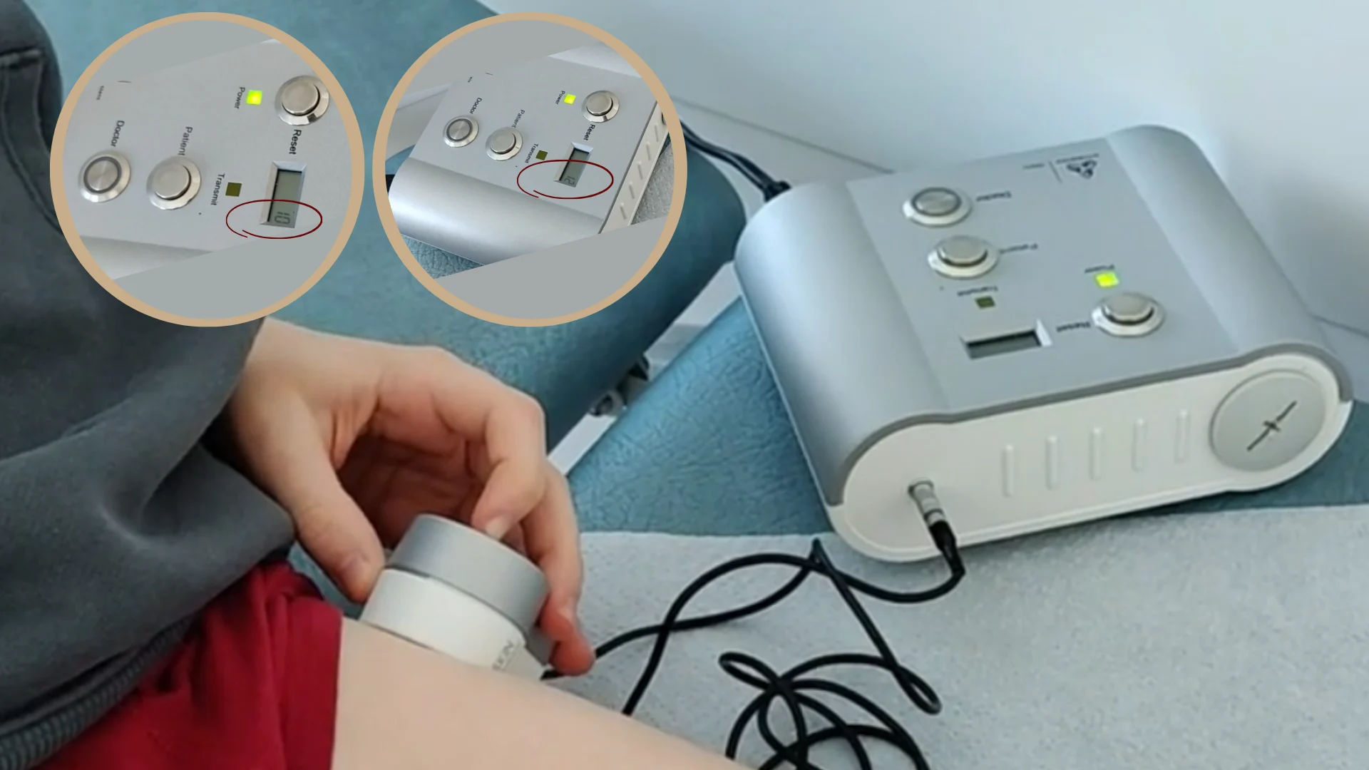 Specialus implantas