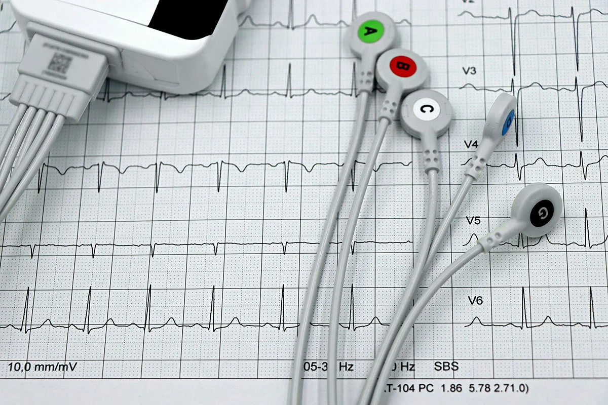 DI širdies ligų diagnostika ir gydymas