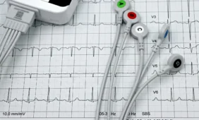 Širdies kraujagyslių ligos. Įranga