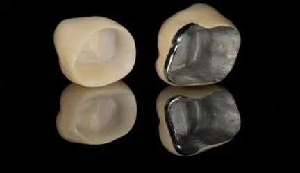 Metalo keramijos vainikėlis