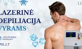 Plaukų šalinimas lazeriu vyrams