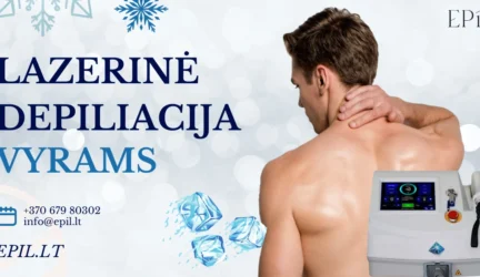Plaukų šalinimas lazeriu vyrams