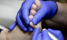 Gilios pėdų nuospaudos