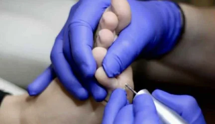 Gilios pėdų nuospaudos