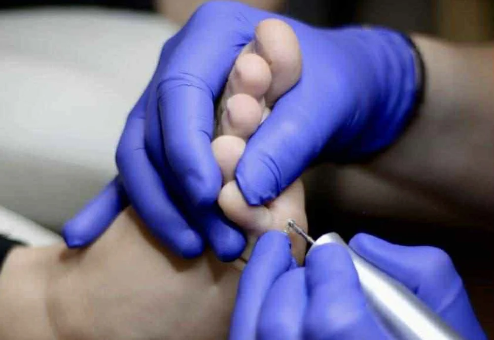 Gilios pėdų nuospaudos