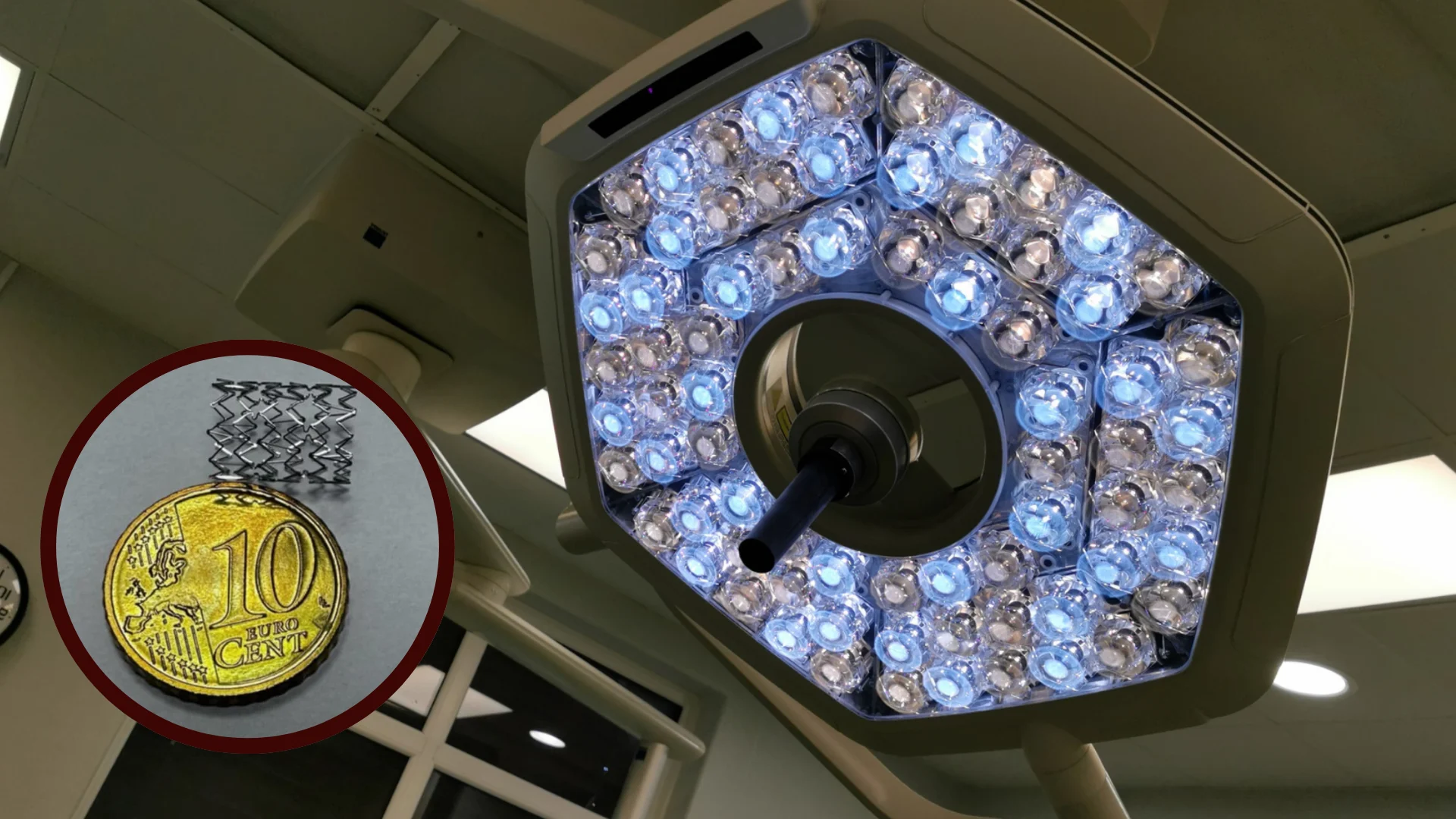 Santaros klinikos operacija