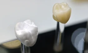 Danties protezavimas