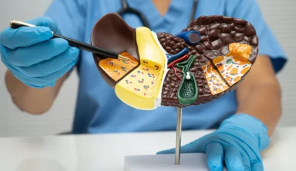 Suriebėjusios kepenys