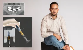 Burnos chirurgas Rokas Kuprys