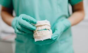 Visi dantys ant 4 implantų